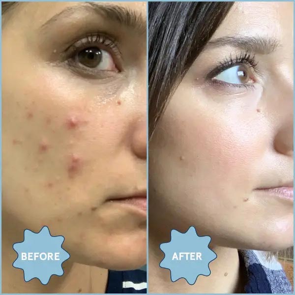 Before and after
